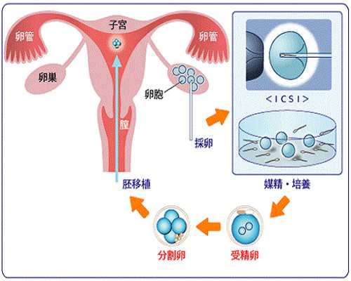 ART-ECO生殖健康诊所：25年运营有9135名儿童出生