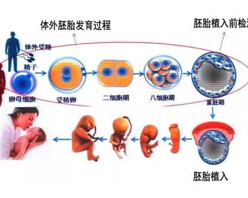 去美国试管攻略，美国试管婴儿流程有哪些？，专业助孕公司