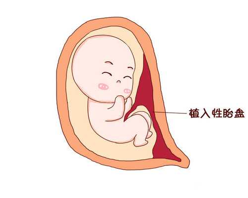 【2026最新】同济医院可以供卵吗？武汉同济生殖中心供卵条件与等待周期解析