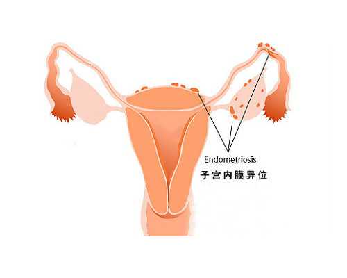 「邵阳做试管婴儿多少钱」邵阳三代试管双胞胎