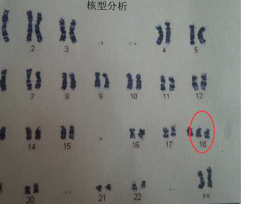2026伊犁妇幼保健院试管婴儿指引，费用明细及成功率参考