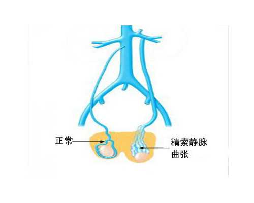 去泰国做试管婴儿花费多少钱？，代生正规机构